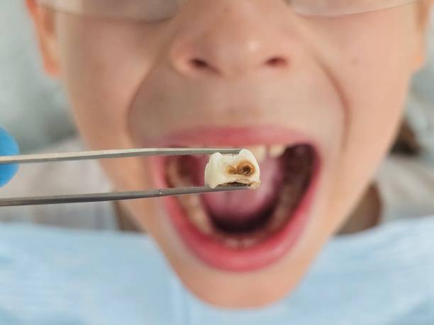 Best Emergency Denture Repair in Century, FL